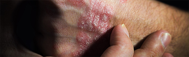 DAP Arzneimittel-News Hauptbeitrag