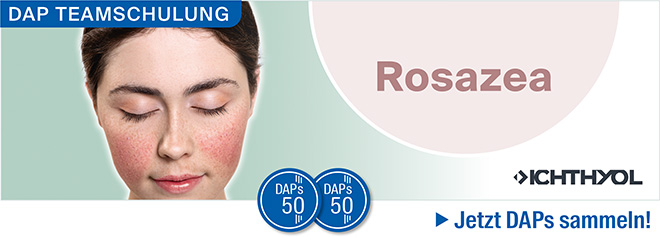 zur Teamschulung Rosazea